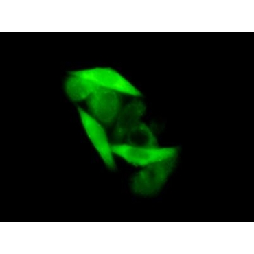 Glyceraldehyde-3-Phosphate Dehydrogenase (GAPDH) Human Polyclonal Antibody