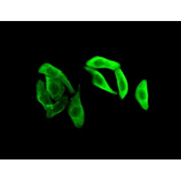 Glyceraldehyde-3-Phosphate Dehydrogenase (GAPDH) Human Polyclonal Antibody