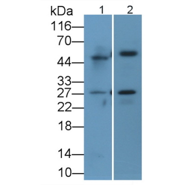 Cathepsin S (CTSS) Human Polyclonal Antibody
