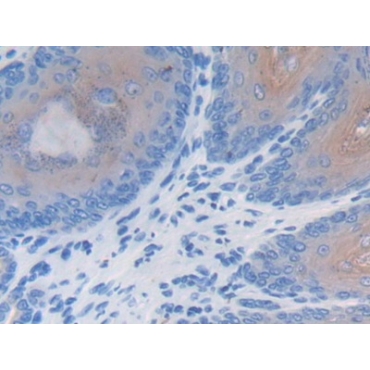 Leucine Rich Alpha-2-Glycoprotein 1 (LRG1) Mouse Polyclonal Antibody