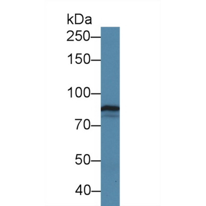 Tenascin X (TNX) Human Polyclonal Antibody