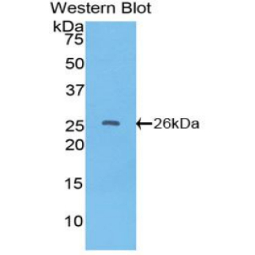Tissue Factor Pathway Inhibitor 2 (TFPI2) Bovine (Cattle) Polyclonal Antibody
