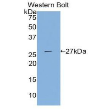 Tissue Factor Pathway Inhibitor 2 (TFPI2) Human Polyclonal Antibody