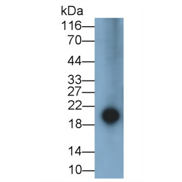 Epiregulin (EREG) Human Polyclonal Antibody