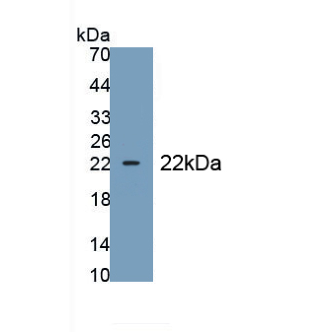 Epiregulin (EREG) Mouse Polyclonal Antibody