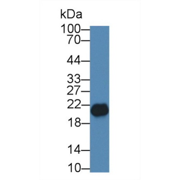 Sperm Protein 17 (Sp17) Human Polyclonal Antibody