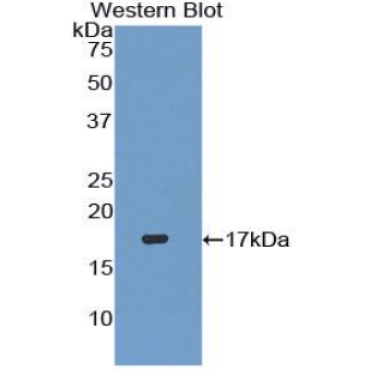Transforming Growth Factor Beta 3 (TGFb3) Human Polyclonal Antibody