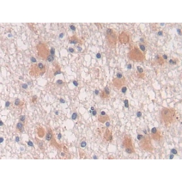 Transforming Growth Factor Beta 3 (TGFb3) Human Polyclonal Antibody