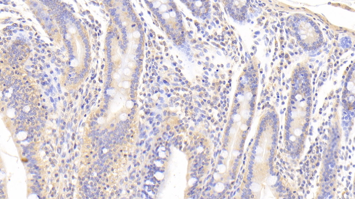 Transforming Growth Factor Beta 3 (TGFb3) Pig Polyclonal Antibody