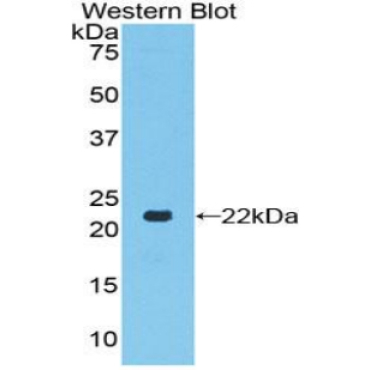 Toll Like Receptor 7 (TLR7) Human Polyclonal Antibody