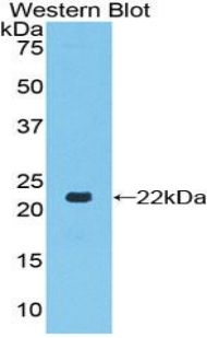 Toll Like Receptor 7 (TLR7) Human Polyclonal Antibody