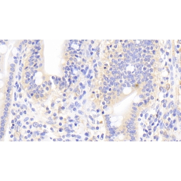 Interleukin 17F (IL17F) Human Polyclonal Antibody