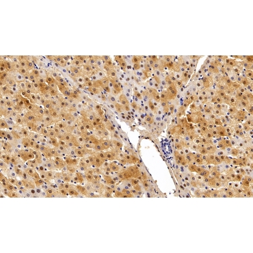 Glutathione S Transferase Alpha 2 (GSTa2) Human Polyclonal Antibody