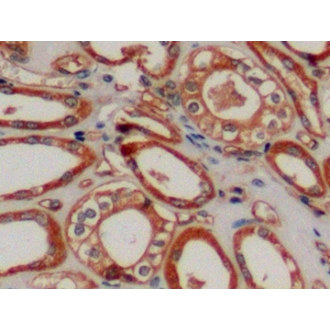 Cluster Of Differentiation 34 (CD34) Human Polyclonal Antibody
