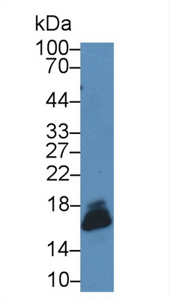Superoxide Dismutase 1 (SOD1) Human Polyclonal Antibody