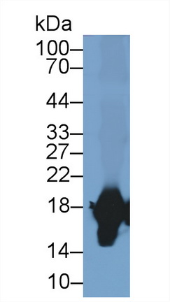 Superoxide Dismutase 1 (SOD1) Rabbit Polyclonal Antibody