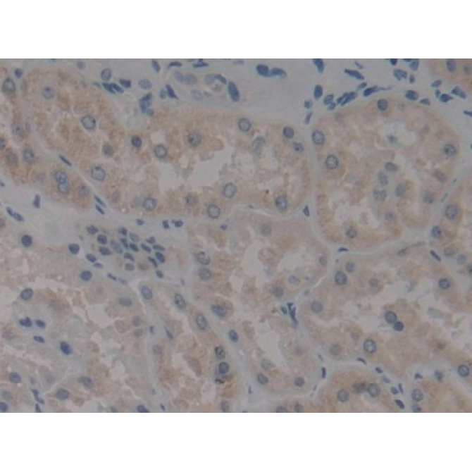 Arachidonate-12-Lipoxygenase (ALOX12) Human Polyclonal Antibody