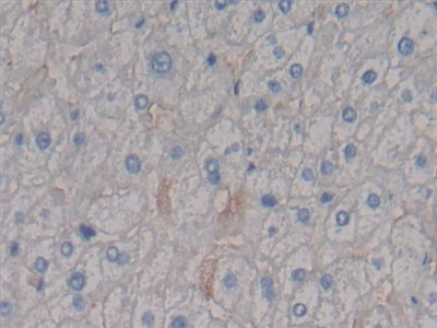 Syndecan 1 (SDC1) Human Polyclonal Antibody