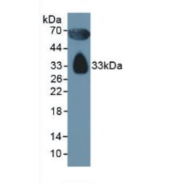 Apolipoprotein D (APOD) Human Polyclonal Antibody