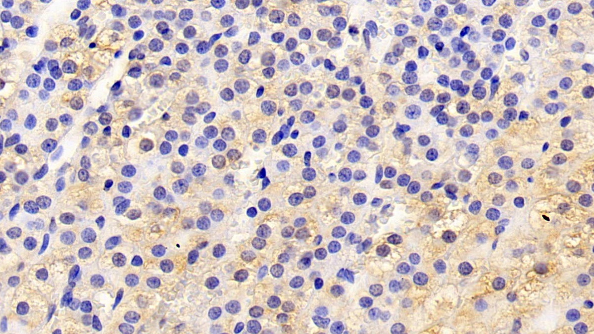 Apolipoprotein D (APOD) Rabbit Polyclonal Antibody