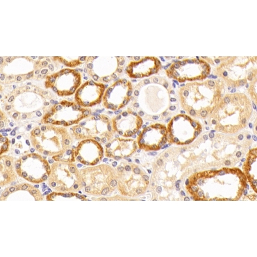 Complement Component 5 (C5) Human Polyclonal Antibody