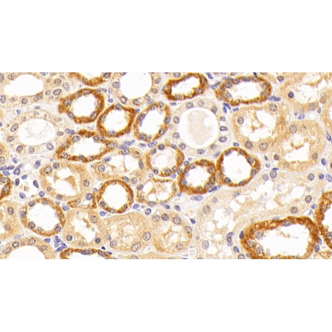 Complement Component 5 (C5) Human Polyclonal Antibody
