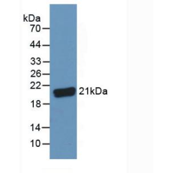 Complement Component 8g (C8g) Human Polyclonal Antibody