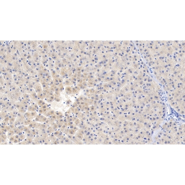 Protein S (PROS) Human Polyclonal Antibody