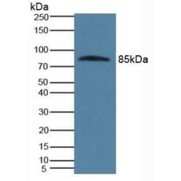 Protein S (PROS) Human Polyclonal Antibody