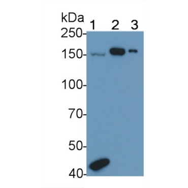 A Disintegrin And Metalloproteinase With Thrombospondin 1 (ADAMTS1) Human Polyclonal Antibody