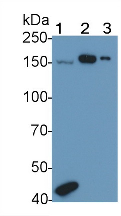 A Disintegrin And Metalloproteinase With Thrombospondin 1 (ADAMTS1) Human Polyclonal Antibody