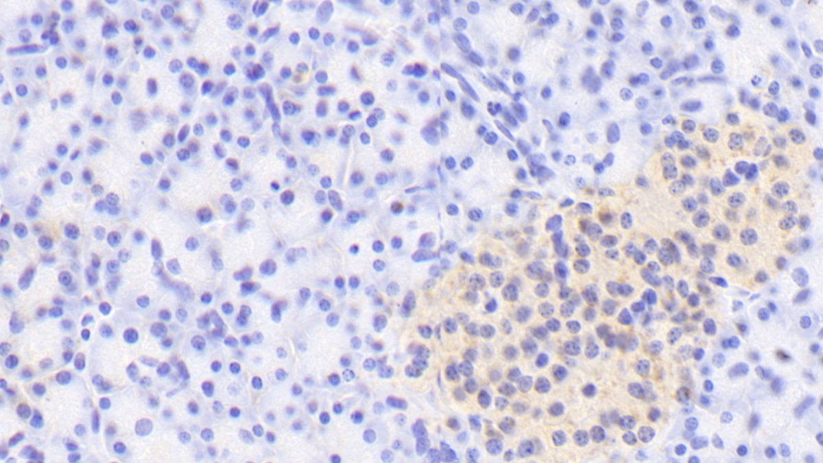 A Disintegrin And Metalloproteinase With Thrombospondin 1 (ADAMTS1) Human Polyclonal Antibody