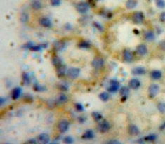 A Disintegrin And Metalloproteinase With Thrombospondin 1 (ADAMTS1) Mouse Polyclonal Antibody