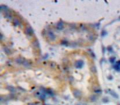 A Disintegrin And Metalloproteinase With Thrombospondin 1 (ADAMTS1) Mouse Polyclonal Antibody