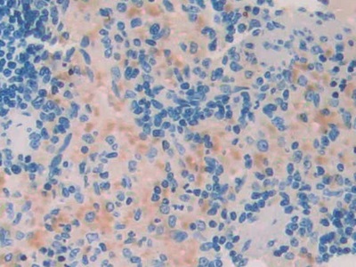 A Disintegrin And Metalloproteinase With Thrombospondin 1 (ADAMTS1) Rat Polyclonal Antibody