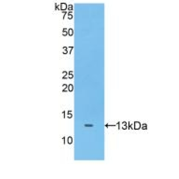 A Disintegrin And Metalloproteinase With Thrombospondin 7 (ADAMTS7) Human Polyclonal Antibody