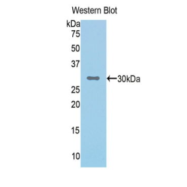 Complement Factor I (CFI) Human Polyclonal Antibody