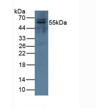 Complement Factor I (CFI) Human Polyclonal Antibody