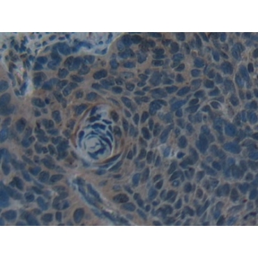 Hepcidin (Hepc) Human Polyclonal Antibody