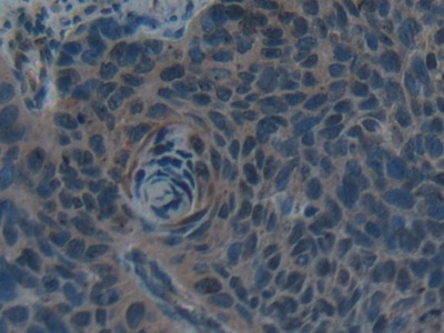 Hepcidin (Hepc) Human Polyclonal Antibody