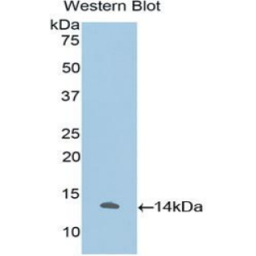 Interleukin 33 (IL33) Human Polyclonal Antibody