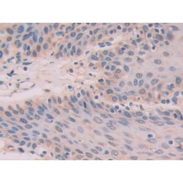 Interleukin 33 (IL33) Human Polyclonal Antibody