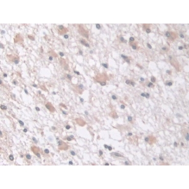 Tau-Protein Kinase 1 (tPK1) Human Polyclonal Antibody