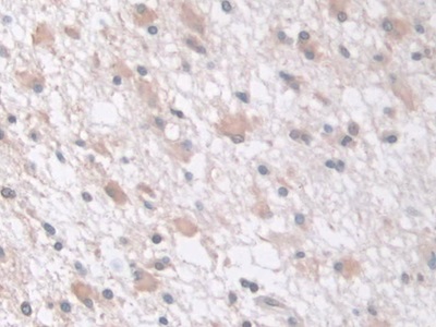 Tau-Protein Kinase 1 (tPK1) Human Polyclonal Antibody