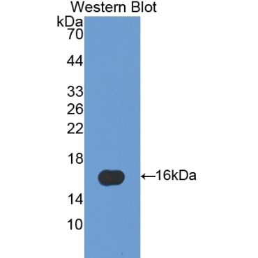Fatty Acid Binding Protein 5 (FABP5) Human Polyclonal Antibody