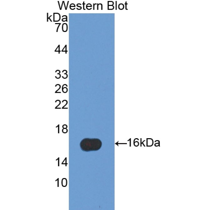 Fatty Acid Binding Protein 5 (FABP5) Human Polyclonal Antibody