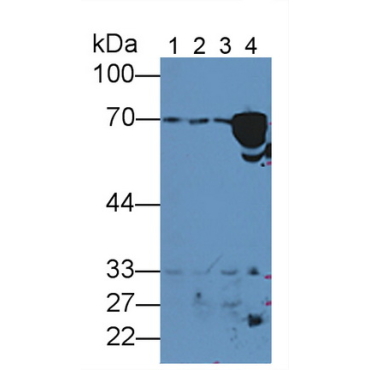 Hemopexin (HPX) Human Polyclonal Antibody