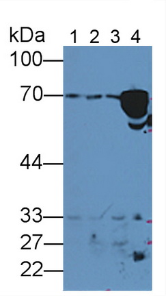 Hemopexin (HPX) Human Polyclonal Antibody