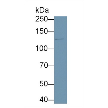 Protein Kinase N2 (PKN2) Human Polyclonal Antibody
