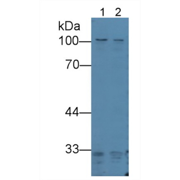 Protein Kinase N2 (PKN2) Human Polyclonal Antibody